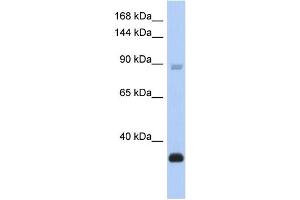 WB Suggested Anti-BCL11B Antibody Titration:  0. (BCL11B Antikörper  (Middle Region))
