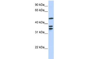 WB Suggested Anti-ETV6 Antibody Titration:  0. (ETV6 Antikörper  (N-Term))