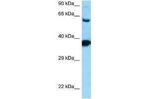 WB Suggested Anti-DRD3 Antibody Titration: 1. (DRD3 Antikörper  (C-Term))