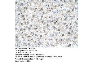 Immunohistochemistry (IHC) image for anti-Nuclear Receptor Subfamily 1, Group I, Member 3 (NR1I3) (C-Term) antibody (ABIN2779924)
