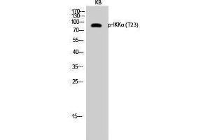 Western Blotting (WB) image for anti-conserved Helix-Loop-Helix Ubiquitous Kinase (CHUK) (pThr23) antibody (ABIN3172912) (IKK alpha Antikörper  (pThr23))