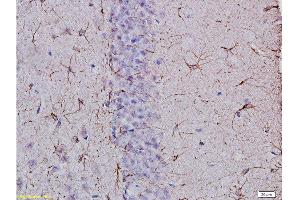 Formalin-fixed and paraffin embedded: rat brain tissue Anti-GFAP Polyclonal Antibody, Unconjugated  at 1:400, followed by conjugation to the secondary antibody and DAB staining (GFAP Antikörper  (AA 51-150))
