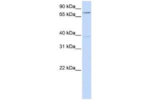 WB Suggested Anti-C17orf80 Antibody Titration:  0. (HLC8 Antikörper  (N-Term))
