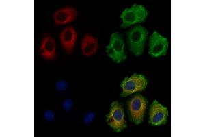 ITIH1 Antibody staining Hela cells by IF/ICC.