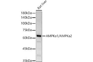 Western blot analysis of extracts of Rat liver, using AMPKa1/AMPKa2 antibody (ABIN6129902, ABIN6136848, ABIN6136849 and ABIN7101410) at 1:1000 dilution. (AMPK alpha Antikörper)