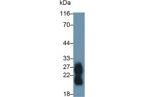 Detection of ZG16B in Human Saliva using Polyclonal Antibody to Zymogen Granule Protein 16 Homolog B (ZG16B)