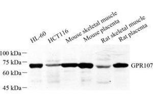 Western blot analysis of GPR107 (ABIN7073995) at dilution of 1: 500 (GPR107 Antikörper)