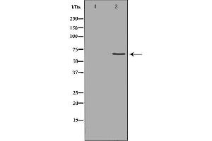 Western blot analysis of extracts of hela , using MMP14 antibody. (MMP14 Antikörper  (C-Term))
