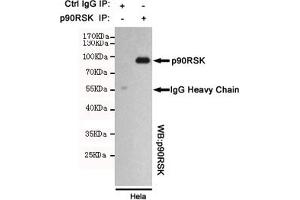 Immunoprecipitation analysis of Hela cell lysates using p90RSK mouse mAb. (RPS6KA3 Antikörper)