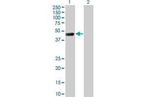 Western Blot analysis of TSSK1 expression in transfected 293T cell line by TSSK1 monoclonal antibody (M01), clone 4F12. (TSSK1B Antikörper  (AA 267-367))