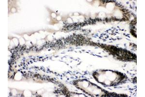 Anti-CTCF Picoband antibody, IHC(P) IHC(P): Rat Intestine Tissue (CTCF Antikörper  (AA 521-727))