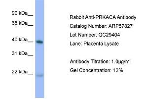 WB Suggested Anti-PRKACA  Antibody Titration: 0. (PRKACA Antikörper  (N-Term))
