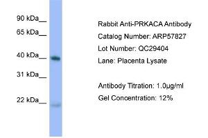 WB Suggested Anti-PRKACA  Antibody Titration: 0.