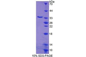 SDS-PAGE (SDS) image for Uridine Monophosphate Synthetase (UMPS) (AA 205-480) protein (His tag) (ABIN6238862) (UMPS Protein (AA 205-480) (His tag))