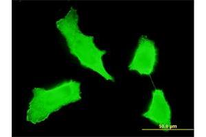 Immunofluorescence of monoclonal antibody to ERBB2 on HeLa cell. (ErbB2/Her2 Antikörper  (AA 22-121))