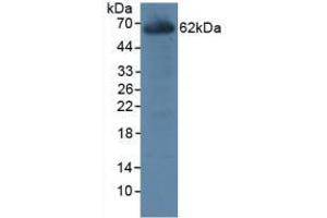 Detection of CES1 in Rat Liver Tissue using Polyclonal Antibody to Carboxylesterase 1 (CES1) (CES1 Antikörper  (AA 19-300))