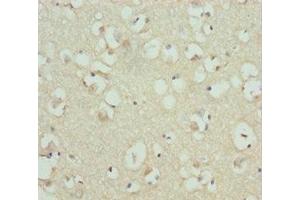 Immunohistochemistry of paraffin-embedded human brain tissue using ABIN7167840 at dilution of 1:100 (RDH12 Antikörper  (AA 182-316))