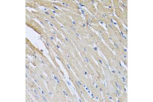 Immunohistochemistry of paraffin-embedded rat heart using CRHBP antibody at dilution of 1:100 (40x lens). (CRHBP Antikörper)