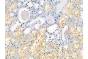 ABIN6259501 and ABIN6273714 at 1/100 staining human normal kidney tissue by IHC-P.