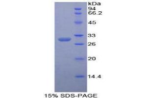 SDS-PAGE analysis of Mouse Contactin 3 Protein. (CNTN3 Protein)