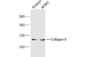 Lane 1: Mouse Embryo lysates Lane 2: MG63 lysates probed with COL2A1 Polyclonal Antibody, Unconjugated  at 1:300 dilution and 4˚C overnight incubation. (COL2A1 Antikörper  (AA 231-330))