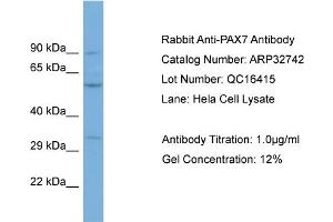 WB Suggested Anti-PAX7 Antibody Titration: 0. (PAX7 Antikörper  (C-Term))