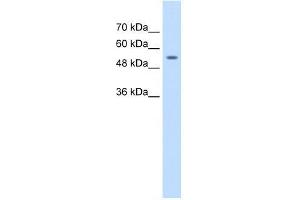 Human Jurkat; WB Suggested Anti-ZNF498 Antibody Titration: 1. (Zinc Finger and SCAN Domain Containing 25 (ZSCAN25) (Middle Region) Antikörper)