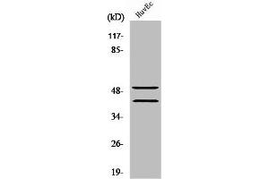 Western Blot analysis of Jurkat cells using TCF-1 Polyclonal Antibody (TCF7 Antikörper  (N-Term))