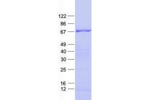 ZNF543 Protein (His tag)