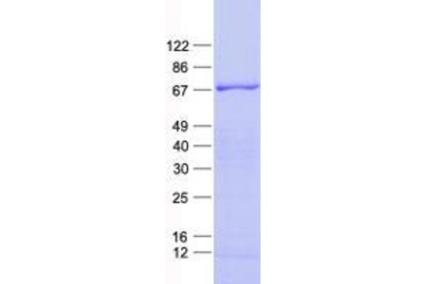 ZNF543 Protein (His tag)