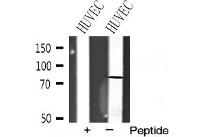Western blot analysis of FSHR expression in HUVEC cell extracts (FSHR Antikörper  (Internal Region))