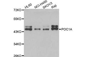 Western blot analysis of extracts of various cell lines, using POC1A antibody (ABIN5975553) at 1/1000 dilution. (POC1A Antikörper)