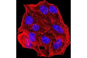 Immunofluorescence analysis of Hela cells using ESR1 mouse mAb. (Estrogen Receptor alpha Antikörper  (AA 2-185))