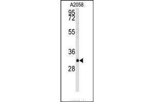 Image no. 1 for anti-WW Domain Binding Protein 2 (WBP2) (C-Term) antibody (ABIN360095) (WBP2 Antikörper  (C-Term))