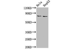 Western Blot Positive WB detected in: Hela whole cell lysate, HepG2 whole cell lysate All lanes: ESRP2 antibody at 6 μg/mL Secondary Goat polyclonal to rabbit IgG at 1/50000 dilution Predicted band size: 79, 78 kDa Observed band size: 79 kDa (ESRP2 Antikörper  (AA 615-720))