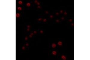 ABIN6266706 staining COLO205 by IF/ICC. (T-Box 1 Antikörper  (C-Term))