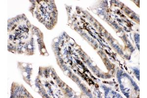 IHC analysis of PKC alpha using anti-PKC alpha antibody (ABIN3043549). (PKC alpha Antikörper  (AA 153-342))
