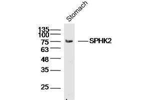 Mouse stomach lysates probed with SPHK2 Polyclonal Antibody, unconjugated  at 1:300 overnight at 4°C followed by a conjugated secondary antibody for 60 minutes at 37°C. (SPHK2 Antikörper  (AA 101-200))