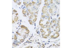 Immunohistochemistry of paraffin-embedded human stomach using PRK antibody (ABIN6132517, ABIN6146187, ABIN6146188 and ABIN6223135) at dilution of 1:100 (40x lens). (PRKAG1 Antikörper  (AA 1-331))