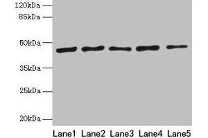 Western blot All lanes: RRM2 antibody at 8 μg/mL Lane 1: HepG2 whole cell lysate Lane 2: Jurkat whole cell lysate Lane 3: Hela whole cell lysate Lane 4: K562 whole cell lysate Lane 5: 293T whole cell lysate Secondary Goat polyclonal to rabbit IgG at 1/10000 dilution Predicted band size: 45, 52 kDa Observed band size: 45 kDa (RRM2 Antikörper  (AA 1-389))