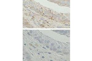 IHC analysis of FFPE human prostate tissue. (Endoplasmic Reticulum Amyloid Binding Protein (ERAB) (AA 199-235) Antikörper)