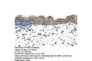 Rabbit Anti-APOBEC2 Antibody  Paraffin Embedded Tissue: Human Skin Cellular Data: Squamous epithelial cells Antibody Concentration: 4. (APOBEC2 Antikörper  (N-Term))