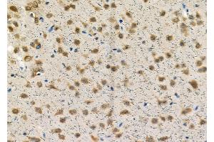 anti-Treacher Collins-Franceschetti Syndrome 1 (TCOF1) (N-Term) antibody