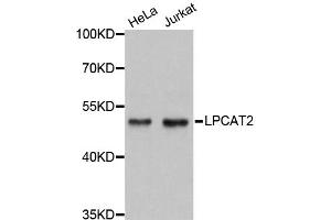 Western blot analysis of extracts of various cell lines, using LPCAT2 antibody (ABIN1876112) at 1:3000 dilution. (LPCAT2 Antikörper)
