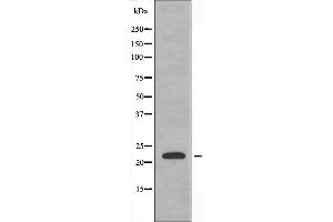 Western blot analysis of extracts from HeLa cells using CBF β antibody. (CBFB Antikörper  (N-Term))