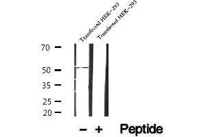 Western blot analysis of extracts of human placenta tissue, using SRPX2 antibody. (SRPX2 Antikörper  (Internal Region))