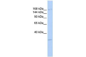 WB Suggested Anti-UTX Antibody Titration: 0. (KDM6A Antikörper  (Middle Region))