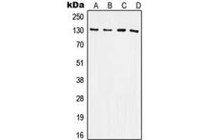 Western blot analysis of CD61 expression in HeLa (A), Raw264. (Integrin beta 3 Antikörper  (C-Term))