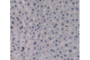 IHC-P analysis of Kidney tissue, with DAB staining. (PTPRJ Antikörper  (AA 1033-1277))