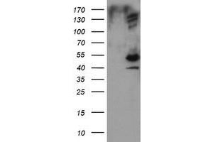 Image no. 1 for anti-DIX Domain Containing 1 (DIXDC1) antibody (ABIN1497840)